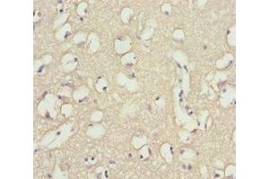 Immunohistochemistry of paraffin-embedded human brain tissue using ABIN7173958 at dilution of 1:100 (INPP4A 抗体  (AA 1-250))