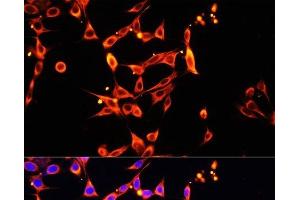 Immunofluorescence analysis of NIH/3T3 cells using Heparanase 1 Polyclonal Antibody at dilution of 1:100. (HPSE 抗体)