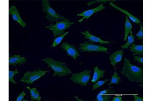 Immunofluorescence of monoclonal antibody to USP9X on HeLa cell. (USP9X 抗体  (AA 1-90))