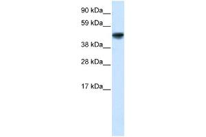 WB Suggested Anti-GAS7 Antibody Titration: 5.