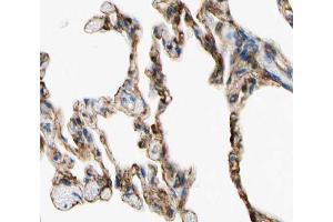 ABIN6266766 at 1/100 staining human lung tissue sections by IHC-P. (TNFAIP8 抗体  (Internal Region))