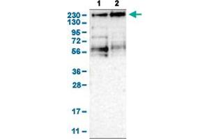 Western Blot analysis of (1) human cell line RT-4, and (2) human cell line U-251MG sp. (KDM3B 抗体  (AA 307-448))