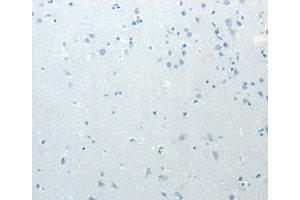 Immunohistochemistry (IHC) image for anti-Minichromosome Maintenance Deficient 4 (MCM4) antibody (ABIN1873665) (MCM4 抗体)