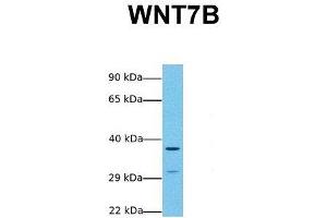 Host:  Rabbit  Target Name:  WNT7B  Sample Tissue:  Human MCF7  Antibody Dilution:  1.