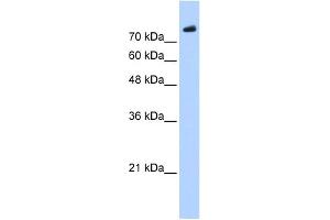 WB Suggested Anti-PHF20 Antibody Titration:  0. (PHF20 抗体  (C-Term))
