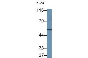 Detection of WARS in Mouse Pancreas lysate using Polyclonal Antibody to Tryptophanyl tRNA Synthetase (WARS) (WARS 抗体  (AA 29-195))