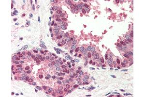Anti-BIK antibody IHC of human prostate. (BIK 抗体  (N-Term))