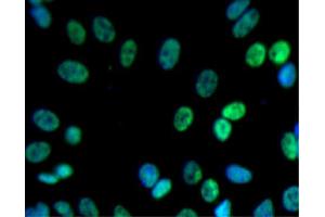 Immunofluorescent staining of SK-N-SH cells (Human neuroblastoma, ATCC HTB-11) (right). (PSIP1 抗体  (AA 85-188))