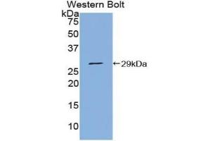 Western blot analysis of the recombinant protein. (PIAS1 抗体  (AA 409-645))