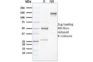 SDS-PAGE Analysis Purified CLEC9A Mouse Monoclonal Antibody (8F9). (CLEC9A 抗体)