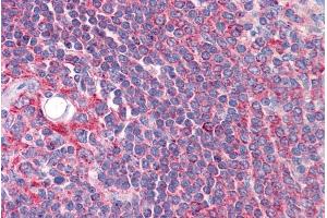 Immunohistochemistry (IHC) image for anti-Cytochrome P450, Family 26, Subfamily B, Polypeptide 1 (CYP26B1) (Internal Region) antibody (ABIN185731)
