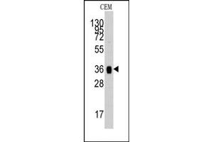Image no. 1 for anti-Aldolase A, Fructose-Bisphosphate (ALDOA) (N-Term) antibody (ABIN357866) (ALDOA 抗体  (N-Term))