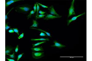 Immunofluorescence of purified MaxPab antibody to SERPINF2 on HeLa cell. (alpha 2 Antiplasmin 抗体  (AA 1-491))