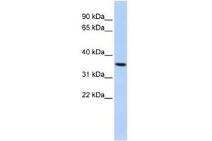 WB Suggested Anti-PAQR6 Antibody Titration:  0. (PAQR6 抗体  (N-Term))
