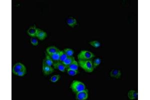 Immunofluorescent analysis of MCF-7 cells using ABIN7158090 at dilution of 1:100 and Alexa Fluor 488-congugated AffiniPure Goat Anti-Rabbit IgG(H+L) (LRRN3 抗体  (AA 201-500))