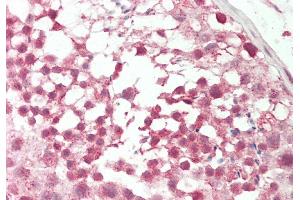 Rabbit Anti-Pou3f1 antibody Catalog Number: ARP33060 Formalin Fixed Paraffin Embedded Tissue: Human Testis Primary antibody Concentration: 1:100 Secondary Antibody: Donkey anti-Rabbit-Cy3 Secondary Antibody Concentration: 1:200 Magnification: 20x Exposure Time: 0. (POU3F1 抗体  (C-Term))