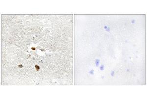Immunohistochemistry (IHC) image for anti-Zinc Finger Protein 287 (ZNF287) (Internal Region) antibody (ABIN1849990) (ZNF287 抗体  (Internal Region))