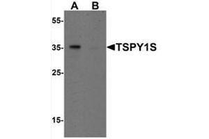 Western blot analysis of TSPY1S in A20 cell lysate with TSPY1S Antibody  at 1 μg/mL in (A) the absence and (B) the presence of blocking peptide (TSPY1 抗体  (C-Term, Isoform 1))