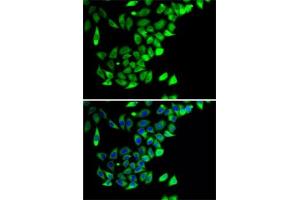 Immunofluorescence analysis of A-549 cells using PTGES2 antibody (ABIN6129085, ABIN6146404, ABIN6146406 and ABIN6222952). (PTGES2 抗体  (AA 88-377))