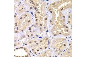 Immunohistochemistry of paraffin-embedded human kidney using PRDM14 antibody at dilution of 1:100 (x400 lens). (PRDM14 抗体)