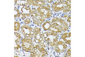 Immunohistochemistry of paraffin-embedded Human stomach using Parkin antibody  at dilution of 1:100 (40x lens).