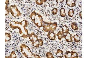 Immunoperoxidase of monoclonal antibody to COASY on formalin-fixed paraffin-embedded human small Intestine. (COASY 抗体  (AA 461-564))