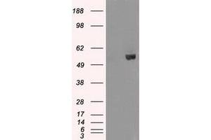 Image no. 2 for anti-V-Akt Murine Thymoma Viral Oncogene Homolog 2 (AKT2) antibody (ABIN1496565) (AKT2 抗体)