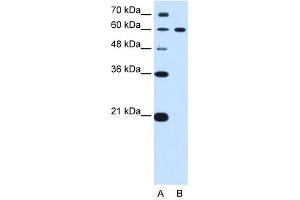 DTX2 antibody used at 0. (DTX2 抗体)