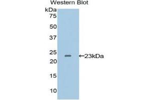 Western blot analysis of the recombinant protein. (VEGFB 抗体  (AA 22-207))