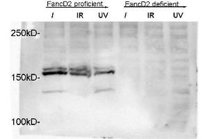 Image no. 2 for anti-Fanconi Anemia, Complementation Group D2 (FANCD2) (N-Term) antibody (ABIN363390) (FANCD2 抗体  (N-Term))