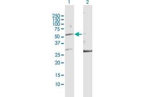 Western Blot analysis of KRT32 expression in transfected 293T cell line by KRT32 MaxPab polyclonal antibody. (KRT32 抗体  (AA 1-448))