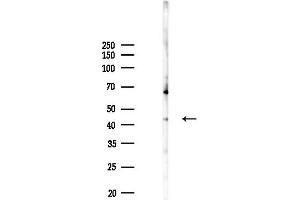 anti-Protein Phosphatase, Mg2+/Mn2+ Dependent, 1A (PPM1A) (C-Term) antibody