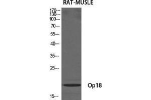 Western Blot (WB) analysis of specific cells using Op18 Polyclonal Antibody. (Stathmin 1 抗体  (Ser729))