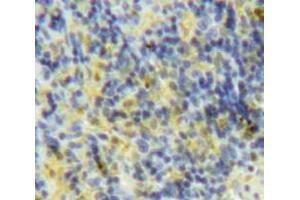 Used in DAB staining on fromalin fixed paraffin-embedded Spleen tissue (XCL1 抗体  (AA 26-111))