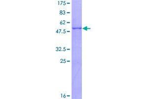 Chymotrypsinogen B1 (CTRB1) (AA 1-263) protein (GST tag)