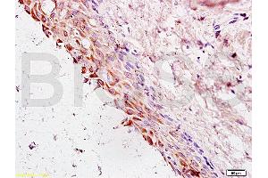 Formalin-fixed and paraffin embedded rat ovary tissue labeled with Anti-Cyclin G Polyclonal Antibody, Unconjugated (ABIN685837) at 1:200 followed by conjugation to the secondary antibody and DAB staining (Cyclin G1 抗体  (AA 181-295))