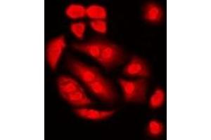 Immunofluorescent analysis of Int11 staining in Hela cells. (CPSF3L 抗体)