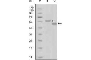 Western Blot showing EphA6 antibody used against truncated MBP-EphA6 recombinant protein (1) and truncated GST-EphA6 (aa695-795) recombinant protein (2). (EPH Receptor A6 抗体  (AA 695-795))