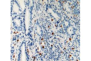 Used in DAB staining on fromalin fixed paraffin- embedded stomach cancer tissue (LAMC2 抗体  (AA 416-602))