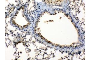 IHC testing of FFEP mouse lung tissue with Periplakin antibody at 1ug/ml. (PPL 抗体  (AA 1664-1701))