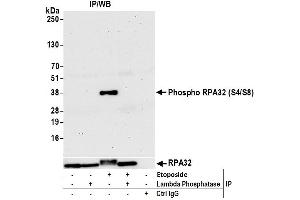 Immunoprecipitation (IP) image for anti-Replication Protein A2, 32kDa (RPA2) (pSer4), (pSer8) antibody (ABIN7455212) (RPA2 抗体  (pSer4, pSer8))