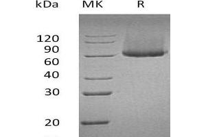 Western Blotting (WB) image for Glypican 1 (GPC1) (Active) protein (His tag) (ABIN7320535) (GPC1 Protein (His tag))