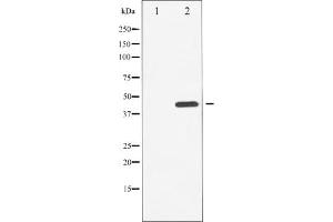 Western blot analysis of Chk1 phosphorylation expression in UV treated HuvEc whole cell lysates,The lane on the left is treated with the antigen-specific peptide.