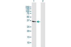 Western Blotting (WB) image for anti-Transaldolase 1 (TALDO1) (AA 1-337) antibody (ABIN948523)