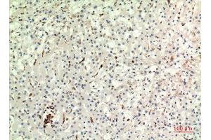 Immunohistochemistry (IHC) analysis of paraffin-embedded Human Liver, antibody was diluted at 1:100. (CD74 抗体  (Internal Region))