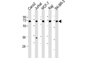 All lanes : Anti-P27 Antibody (Center) at 1:2000 dilution Lane 1: Caco2 whole cell lysates Lane 2: Jurkat whole cell lysates Lane 3: MCF-7 whole cell lysates Lane 4: Raji whole cell lysates Lane 5: SK-BR-3 whole cell lysates Lysates/proteins at 20 μg per lane. (MMP27 抗体  (AA 333-367))