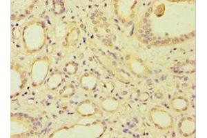 Immunohistochemistry of paraffin-embedded human kidney tissue using ABIN7144692 at dilution of 1:100 (ARSF 抗体  (AA 1-200))