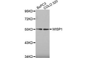 Western blot analysis of extracts of various cell lines, using WISP1 antibody. (WISP1 抗体  (AA 158-367))