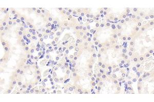 Detection of SOX18 in Rat Kidney Tissue using Polyclonal Antibody to Sex Determining Region Y Box Protein 18 (SOX18) (SOX18 抗体  (AA 153-377))