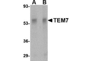 Western blot analysis of TEM7 in rat liver tissue lysate with this product at (A) 0. (PLXDC1 抗体  (Center))